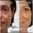/album/algunos-resultados-reales/a11296933-1595486297401440-2138858280-n-copia-copia-jpg/